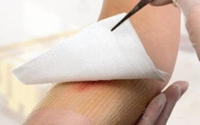 Residuos biosanitarios